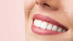 post-estética-odontológica