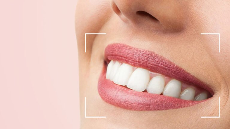 post-estética-odontológica