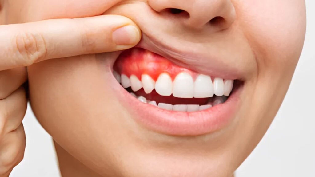 post-periodontia-palmas